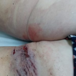 Mulher é ferida após ser  atacada por Pitbull em Novo Machado